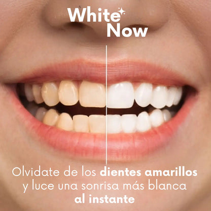 ESMALTE BLANQUEADOR DENTAL WhiteNow™ - SONRISA BLANCA SIN TRATAMIENTOS